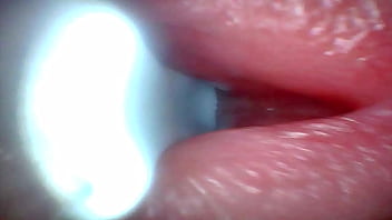 Endoscope camera captures moment of male ejaculation