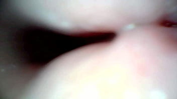 Endoscope camera captures moment of male ejaculation