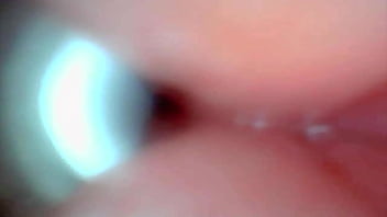 Endoscope camera captures moment of male ejaculation