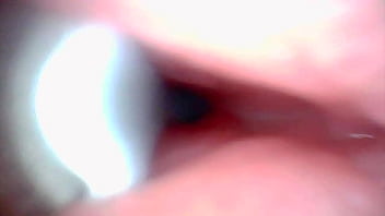 Endoscope camera captures moment of male ejaculation