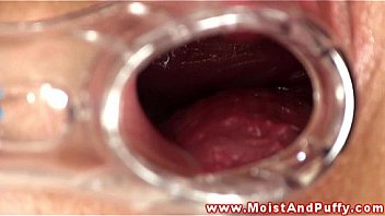 Puffy peach teen plays with speculum