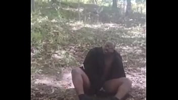 Introducing how my skin also gets sometimes when the weather gets hot and sunny in the summertime while wearing flasher coat to cover the rest of my body from developing too much allergies1