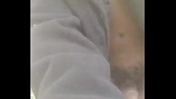 Introducing how my skin also gets sometimes when the weather gets hot and sunny in the summertime while wearing flasher coat to cover the rest of my body from developing too much allergies1