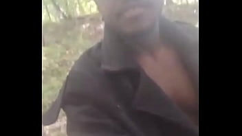 Introducing how my skin also gets sometimes when the weather gets hot and sunny in the summertime while wearing flasher coat to cover the rest of my body from developing too much allergies1