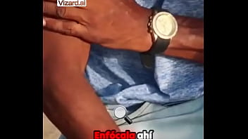 Una herida que cuenta una historia #historias #cosasdelavida