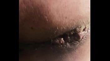 Más turbación de ano 1