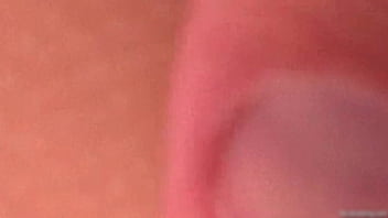 Cindy shine gets facial in eye after casting