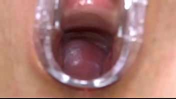 Gyno toy and hard cunt opening