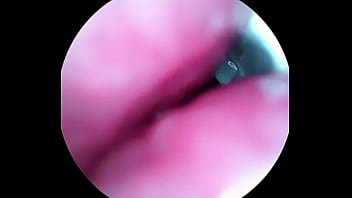 Video inside dick