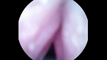 Video inside dick