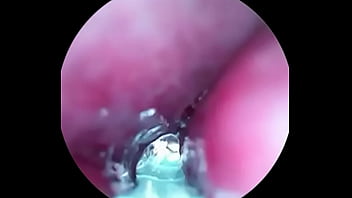 Video inside dick