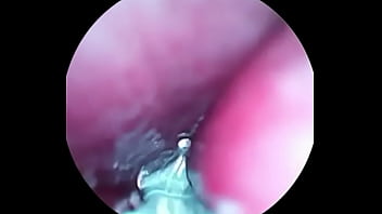 Video inside dick