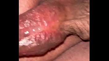 Masturbating my hypospadias cock to orgasm