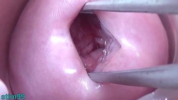 Lesbians pissing into the cervix of the other one directly since her pee hole Lesbians pissing into the cervix of the other one directly since her pee hole