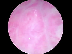 Play MP4 - Camera inside of my creamy juicy pussy until I cum hard&excl;&excl;